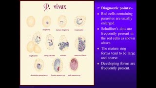 Laboratory diagnosis of malaria parasite [upl. by Corena]