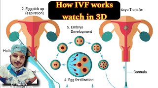 IVF in 3D  How IVF works  in vitro fertilization  IVF invitro invitrofertilization neet2024 [upl. by Yenffad]