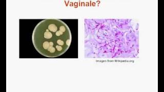 Mycose Vaginale  Mycoses Vaginales [upl. by Charteris]