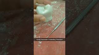 Cavity Preparation Of Maxillary Premolar ytshorts ytshorts Happysmiles16 [upl. by Prue879]