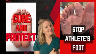 Stop Athletes Foot Podiatrists 4 Proven Ways to Cure and Prevent it plus natural remedies [upl. by Deer]