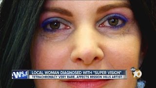 San Diego woman Concetta Antico diagnosed with super vision [upl. by Eerak48]