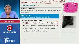 2024 NEUMOLOGÍA Micosis pulmonares Histoplasmosis [upl. by Aicilanna]