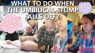 Newborn Umbilical Stump Falls Off What To Do First Time Parents Reaction [upl. by Adore79]