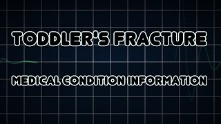 Toddlers fracture Medical Condition [upl. by Naid]