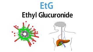 EtG Test [upl. by Julienne]