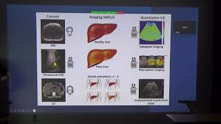 2 강의한정훈 NAFLD 2024년7월4일 영남 임상 초음파 연구회 강좌 [upl. by Takeo181]