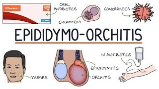 EpididymoOrchitis  epididymis [upl. by Klimesh]