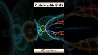 How To Recognize Optic Neuritis And MS [upl. by Kitti]