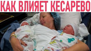 КЕСАРЕВО СЕЧЕНИЕ ИЗМЕНЯЕТ ЧЕЛОВЕЧЕСТВО  Как кесарево сечение влияет на нас [upl. by Othilia]