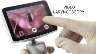 Video laryngoscopy [upl. by Wilde]