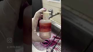 Afb stain  sputum test  test for tb  mycobacterium tuberculosis test [upl. by Ovatsug]