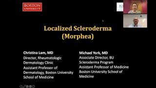 Localized Scleroderma Morphea Christina Lam MD Michael York MD [upl. by Annayrb71]