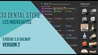 Exocad 30 Galway V2 par 3D Dental Store [upl. by Llehsram]
