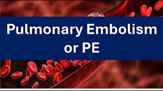 Pulmonary Embolism Short March 2024 [upl. by Dal400]