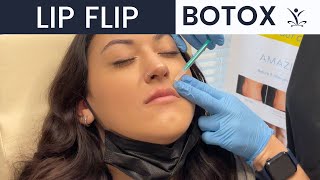 BOTOX Lip Flip Injections [upl. by Ibob523]