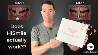 HiSmile Review By A Dentist Dr Grant McGrath [upl. by Niro]