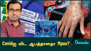 Mpoxல் இருந்து எப்படி தப்பிக்கலாம்  DrFarook Abdullah  Oneindia Tamil [upl. by Porter]