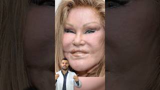 Jocelyn Wildenstein Früher vs Heute jocelynwildenstein katzenfrau frühervsheute beautydoc [upl. by Ahtnama]