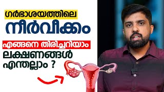 ഗർഭാശയത്തിൽ നീർവീക്കം ഉണ്ടോ  എങ്ങനെ തിരിച്ചറിയാം  ലക്ഷണങ്ങൾ എന്തല്ലാം [upl. by Eevets]