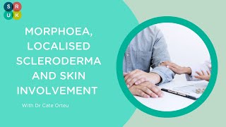 Webinar Morphoea Localised Scleroderma amp Skin Involvement [upl. by Carilyn]