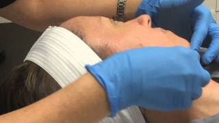 Dermaplaning at LUX A Medical Spa [upl. by Elyssa]