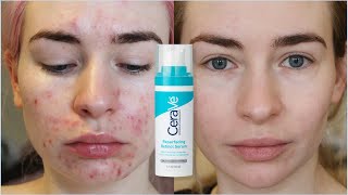 Cerave resurfacing retinol serum review [upl. by Airoled]