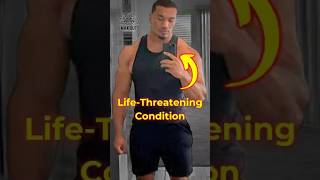 Larry Wheels Hospitalized Rhabdomyolysis Explained Max Out shorts fitness gym maxstrength [upl. by Mello]