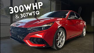 Elantra NLine 300WHP tuned by JV Performance Aramis Otero  DIPR Car Stories 74 [upl. by Bakki]