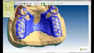 Logiciel CAO DIGISTELL pour la création de châssis squeletté pour prothésistes dentaires Part 2 [upl. by Joung400]