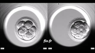 Evolution de deux embryons dans un Embryoscope [upl. by Nicol]