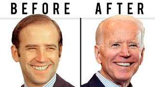 Joe Bidens NEW FACE  Plastic Surgery Analysis [upl. by Adnalue]