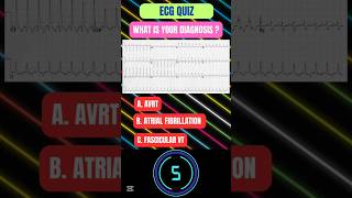 ECG Quiz Challenge  shorts quiz shortvideo ecg cardiology ‎MedEd360 [upl. by Emily]