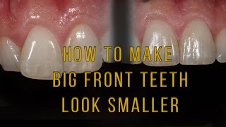 What to do if one tooth looks big and long [upl. by Zelde]