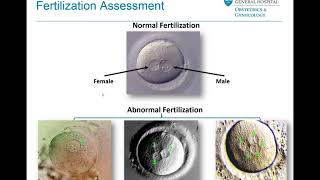 Embryo Selection and Transfer  Mass General Fertility Focus Webinar [upl. by Patty892]