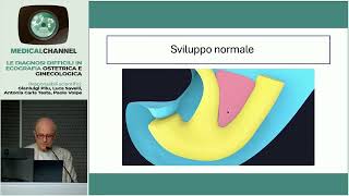 Estrofia della vescica Segni ecografici e difficoltà diagnostiche  P Volpe [upl. by Goode]