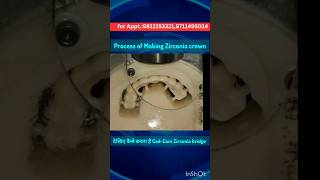 See the making of Zirconia CadCam Zirconia crown zirconia dentalcrowns [upl. by Aihsemak496]