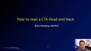 How to read a CT angiogram CTA of the Head and Neck [upl. by Sudaorb]