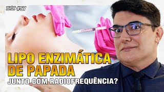 Lipo Enzimática de Papada junto com Radiofrequência Funciona  Sua Dúvida Vira Vídeo 57 [upl. by Del]