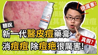 新一代醫皮痘 EPIDUO FORTE 藥膏，可以消痘痘、除痘疤，真假？皮膚科楊省三醫師幫你詳細分析醫皮痘複方凝膠，為何痘痘肌患者滿意度高！ [upl. by Curtis]