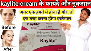 kaylite cream  Kaylite cream ke fayde  kaylite cream kaise use karte hain DrxMedihelp [upl. by Nedloh]