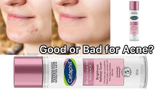 Reduce Acne Marks  Cetaphil Toner works in pimples cetaphiltoner cetaphil cetaphilcleanser [upl. by Ahsiatal]