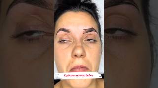 Shape sourcils avant microblading microblading microbladingeyebrows microbladingeyebrows microb [upl. by Auqinet]