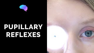 Pupillary Reflexes  OSCE Guide Clip  UKMLA  CPSA [upl. by Montana]