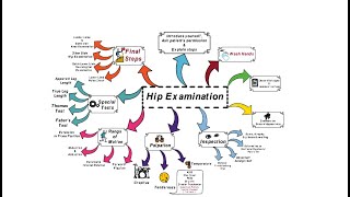 Hip Examination  OSCE [upl. by Aileme]