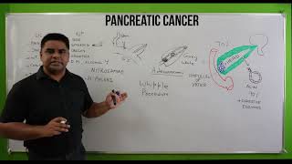 Pancreatic Cancer Symptoms  Pancreas Cancer  अग्नाशय कैंसर  Cause amp Pancreatic Cancer Treatment [upl. by Orella]