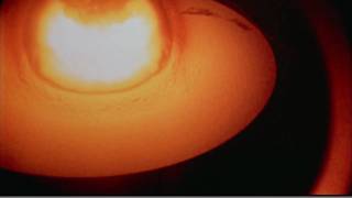 Castle Bravo  Huge thermonuclear explosion [upl. by Leirraj]