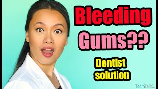 Bleeding Gums What a Dentist recommends [upl. by Aiuqes]