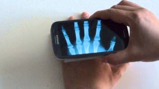 Xray Scan Android Review [upl. by Elleda905]