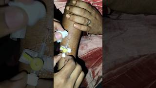 iv canula kese nikalte hai ytshorts shorts trending nursing doctor viralshort neet mbbs [upl. by Tnert949]